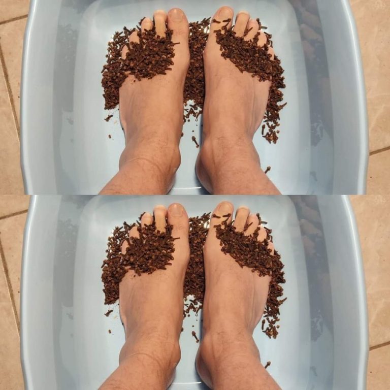 Posmaruj stopy goździkami i jestem zachwycona efektem