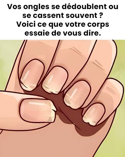 7 problemów zdrowotnych ukrytych w paznokciach