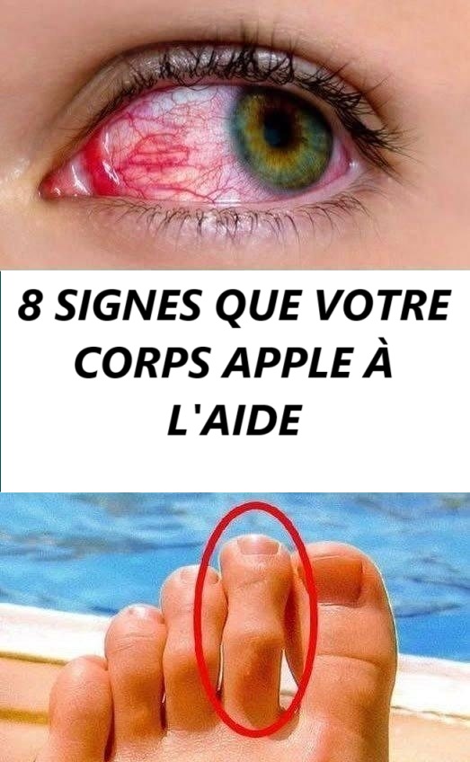 8 oznak, że Twoje ciało potrzebuje pomocy