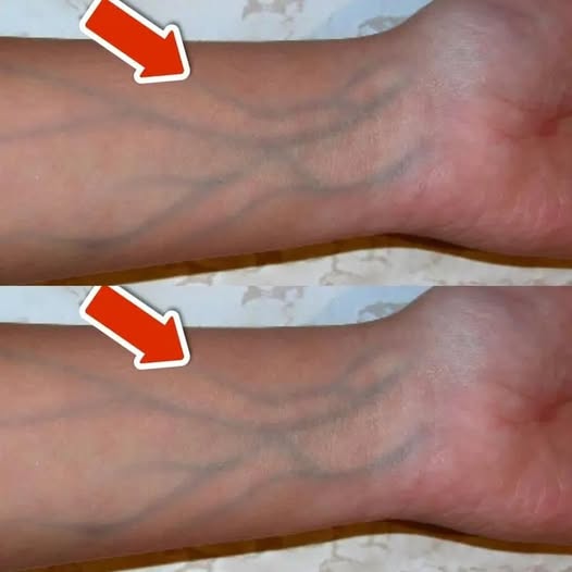 5 oznak słabego krążenia, których nigdy nie należy ignorować 😮 link znajduje się w pierwszym komentarzu