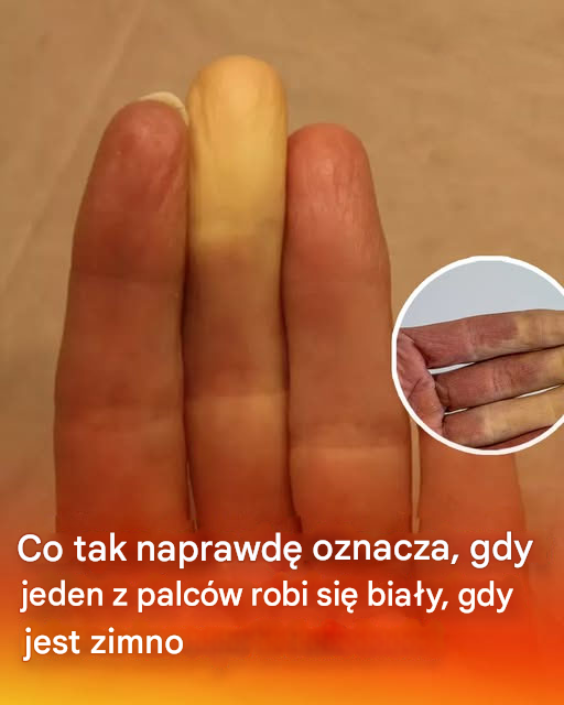Co tak naprawdę oznacza, gdy jeden z palców robi się biały, gdy jest zimno