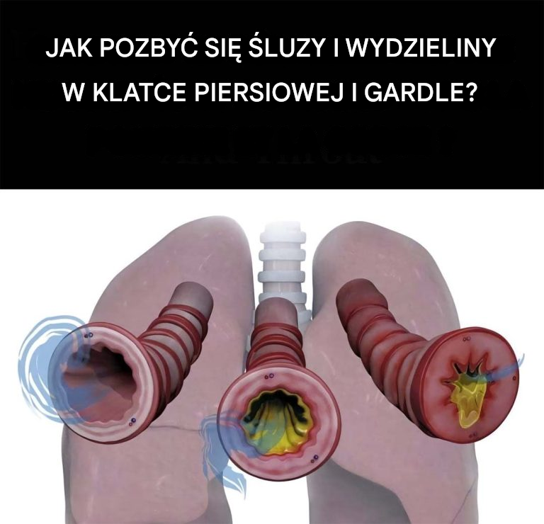 8 sposobów na pozbycie się flegmy i śluzu w klatce piersiowej i gardle