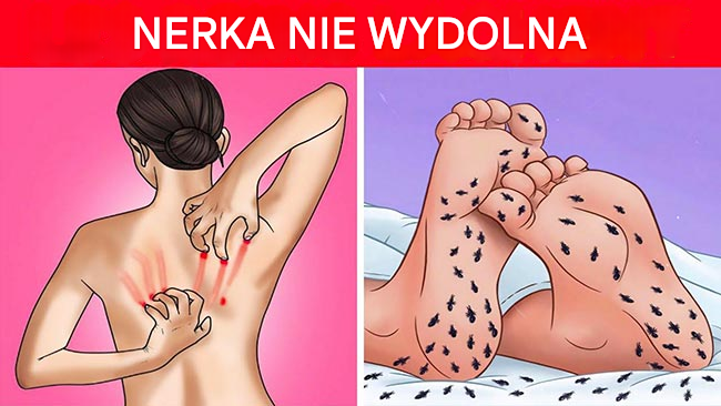 „🚨 Twoje nerki wysyłają Ci sygnały! Oto 8 dziwnych znaków, które wskazują, że potrzebują pomocy 🩺💧. Nie ignoruj ​​ich! Dbaj o swoje zdrowie. 💡💬👇”… Zobacz więcej