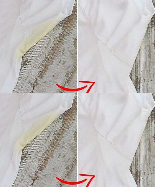 6 wskazówek, jak usunąć żółte plamy z białych ubrań i nadać im blask!