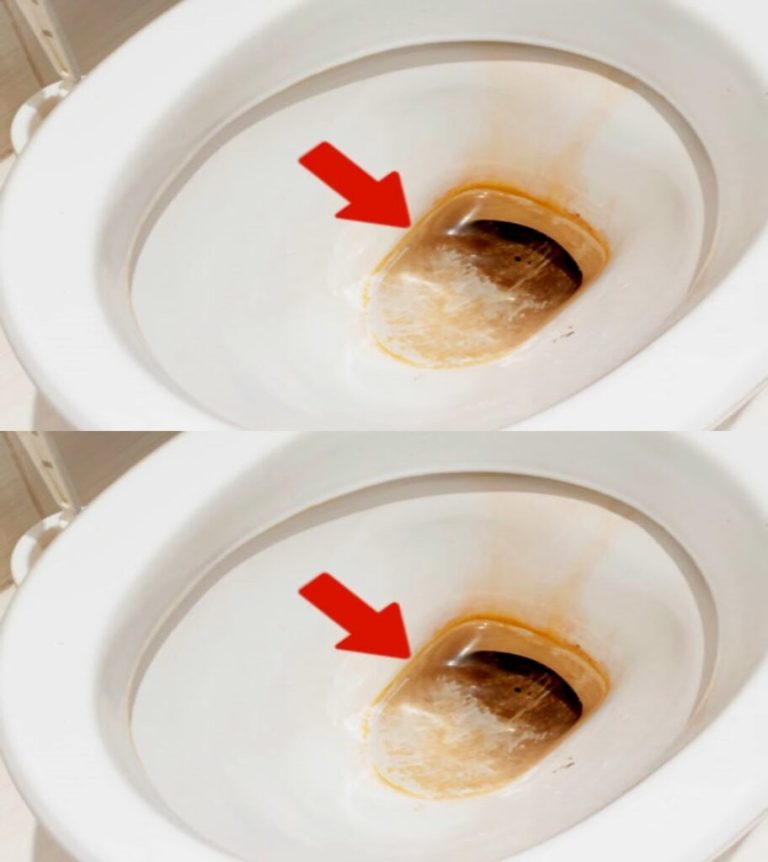 Nieprzyjemne zapachy w toalecie: jak się ich pozbyć i sprawić, by w toalecie ładniej pachniało?Otwierasz drzwi do domu po długim dniu pracy, chcąc położyć się na kanapie, by odpocząć i się zrelaksować, ale odpychający zapach natychmiast Cię odpycha i odbiera ochotę na opalanie się przed telewizorem. Tak, wiesz... Ten zapach, który pojawia się w Twojej łazience i stopniowo zalewa Twoje przytulne gniazdko, niszcząc całe Twoje wnętrze! Wyobraź sobie, że możesz się go pozbyć, szybko i na zawsze! Dlaczego Twoja toaleta źle pachnie? Niezależnie od tego, czy chodzi o brudną toaletę, czy problem z instalacją wodno-kanalizacyjną, aby sobie z nimi poradzić, trzeba wiedzieć, skąd pochodzą niepożądane zapachy!  Przyczyna nr 1: Zatkane rury Brud gromadzący się w rurach może się gromadzić i tworzyć grudki, które zatykają rury i powodują wydobywanie się z toalety nieprzyjemnych zapachów. Do usunięcia tego brudu nie można się dostać, konieczna jest interwencja fachowca.  Problem może być jednak mniej poważny, a nieprzyjemne zapachy mogą pochodzić wyłącznie z brudu znajdującego się pod deską sedesową lub z trudno dostępnych miejsc, np. spod krawędzi muszli klozetowej. Sprawdź więc dokładnie te miejsca i wyczyść je.  ciąg dalszy na następnej stronie