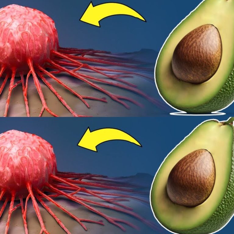 UWAGA! Jeżeli jadłeś AWOKADO, zwróć uwagę na następujące kwestie. Nawet jedno AWOKADO może wywołać nieodwracalną reakcję!