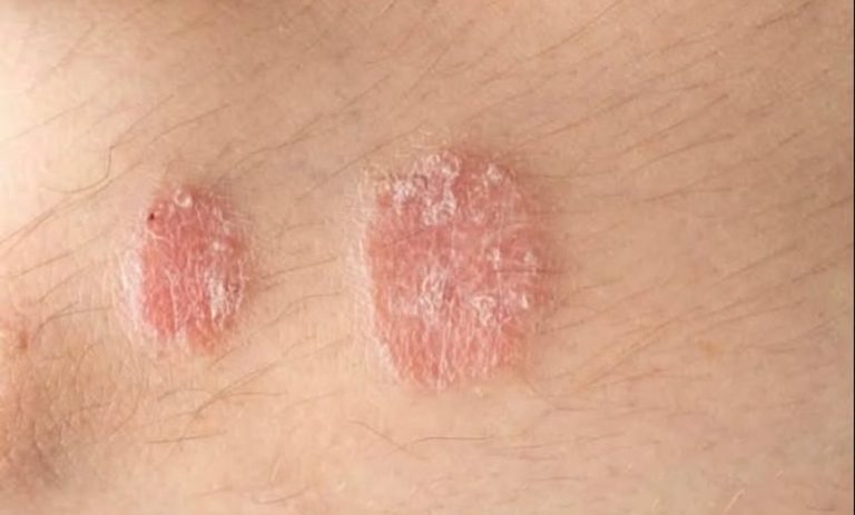 Jeśli zauważysz u siebie te objawy, natychmiast skontaktuj się z lekarzem!