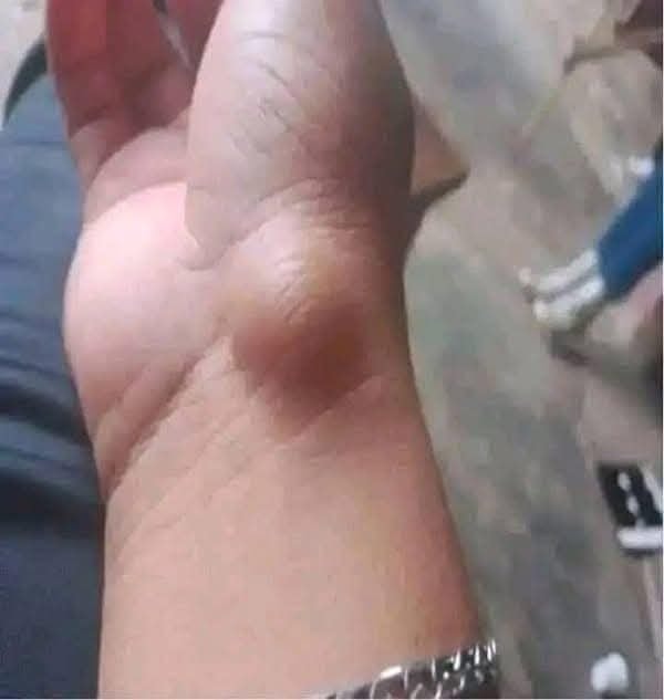 Zwróć szczególną uwagę na te objawy, gdyż może to być coś poważniejszego, niż się wydaje.