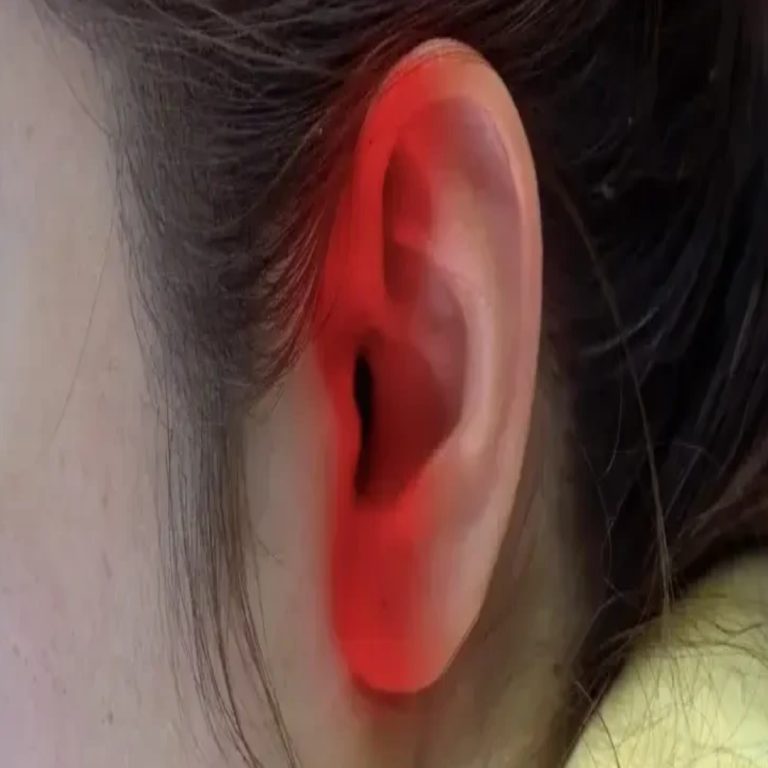Co oznacza, gdy ucho staje się gorące i czerwone?