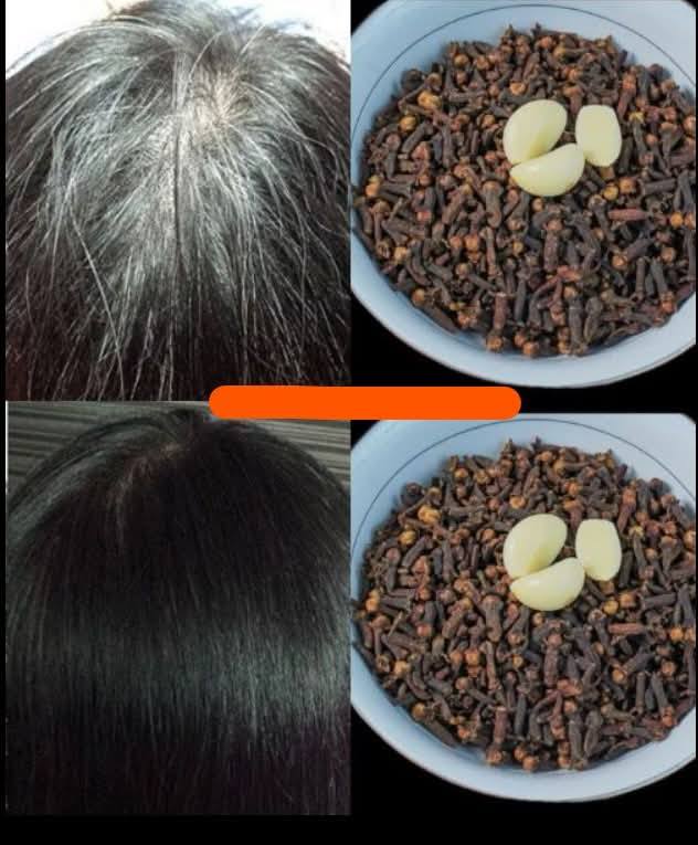 Siwe lub białe włosy są często uważane za naturalną część starzenia się!