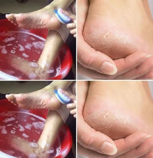 Idealne, młodziej wyglądające stopy w 10 minut dzięki makijażowi miednicy