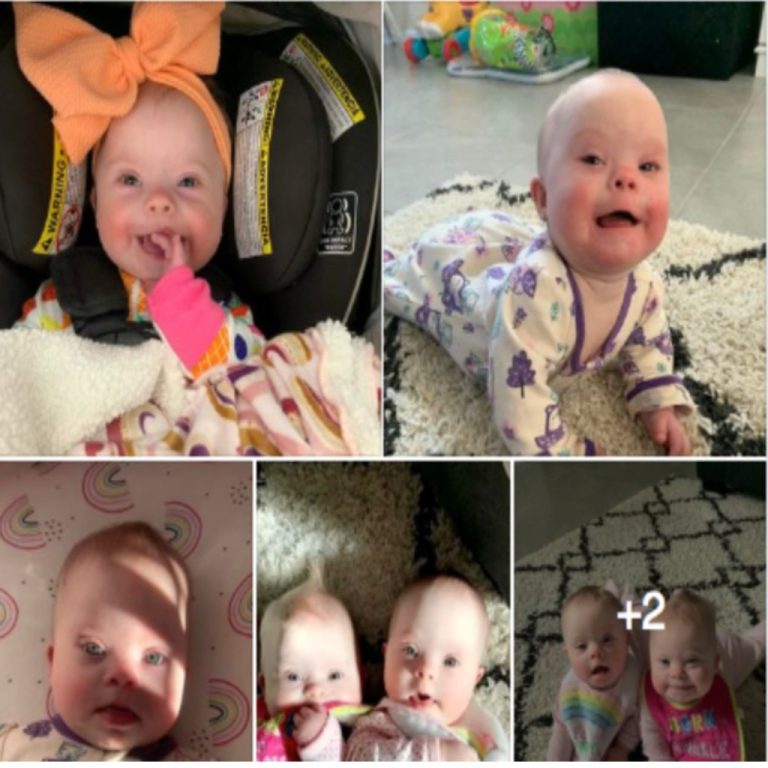 Mama rzadkich bliźniaków z zespołem Downa pokazuje, jak piękne i cenne są, by uciszyć krytyków