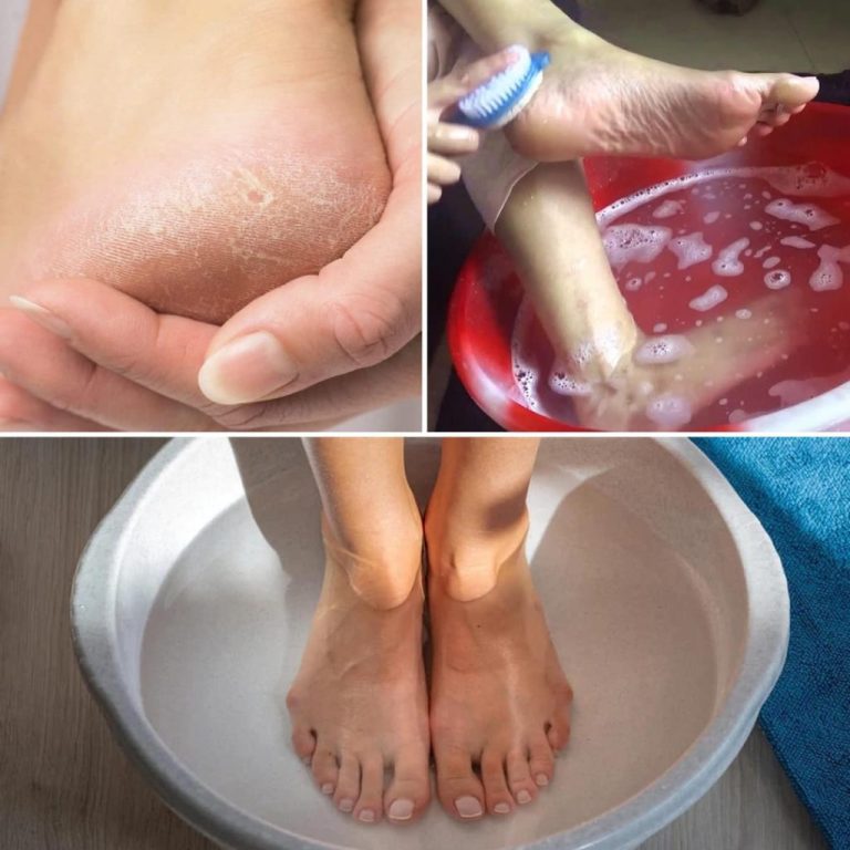 Idealne, młodziej wyglądające stopy w 10 minut dzięki makijażowi miednicy