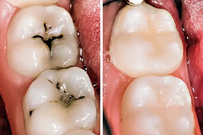 8 wskazówek, jak lepiej dbać o zęby