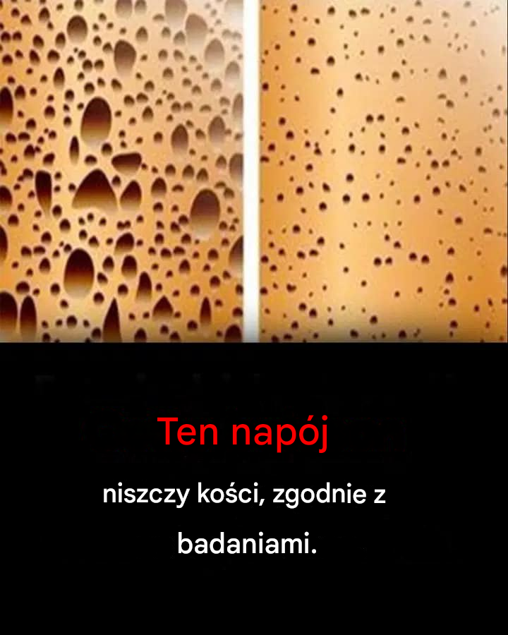 Szokująca prawda: Ten popularny napój może niszczyć Twoje kości