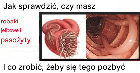 Jak sprawdzić, czy masz pasożyty jelitowe i co zrobić, aby się ich pozbyć