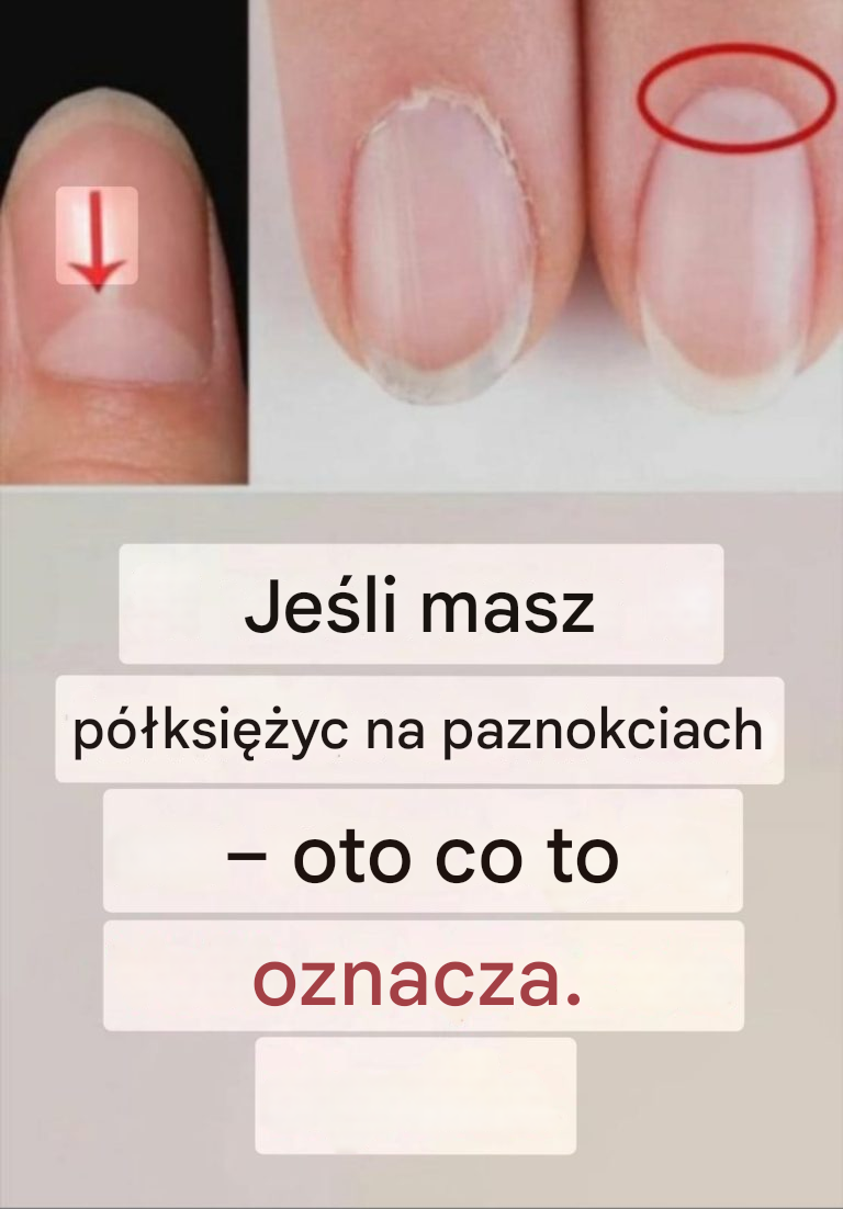 Jeśli Twoje paznokcie mają kształt półksiężyca, oto co to oznacza