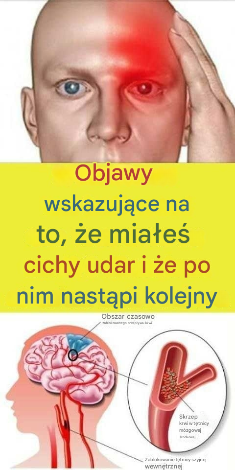 Jakie są objawy ostrzegawcze udaru? Jak zareagować?