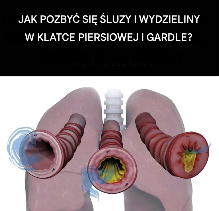 8 sposobów na pozbycie się śluzu i flegmy w klatce piersiowej i gardle