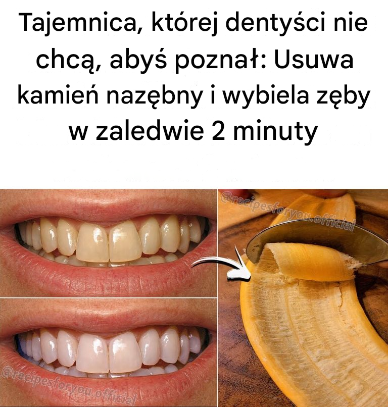 Tajemnica, której dentyści nie chcą, abyś poznał: Usuwa kamień nazębny i wybiela zęby w zaledwie 2 minuty