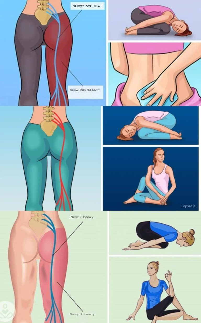 5 ćwiczeń zapobiegających bólom pleców