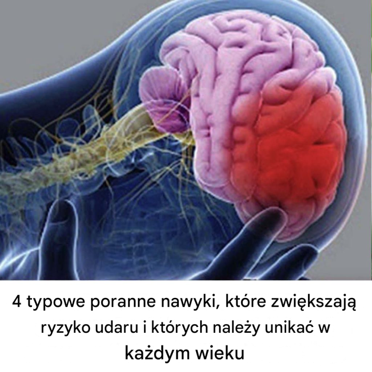 4 typowe poranne nawyki, które zwiększają ryzyko udaru i których należy unikać w każdym wieku