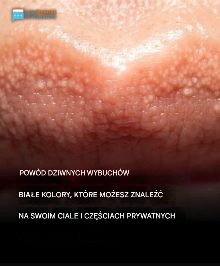 Przyczyna dziwnych białych pryszczy na ciele