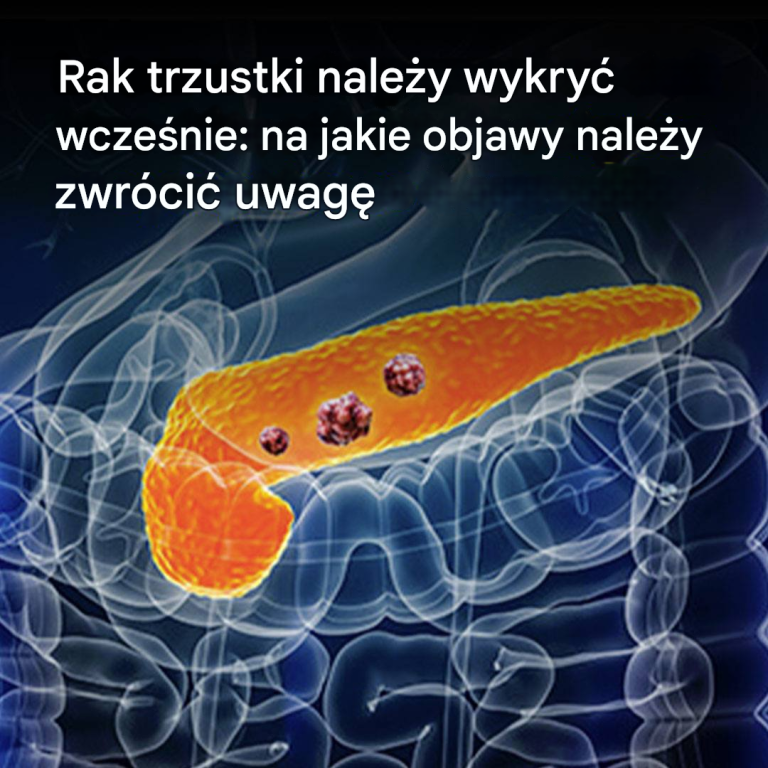 10 oznak raka trzustki, których nie należy ignorować