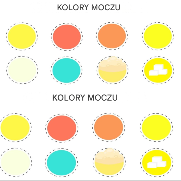 Kolor moczu może ujawnić wszystko na temat Twojego zdrowia! (Pilnie zapoznaj się z tą listą!)