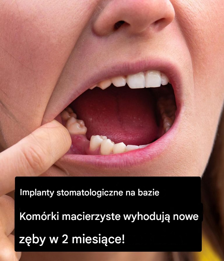 Implanty stomatologiczne na bazie komórek macierzystych mogą w przyszłości zastąpić protezy zębowe