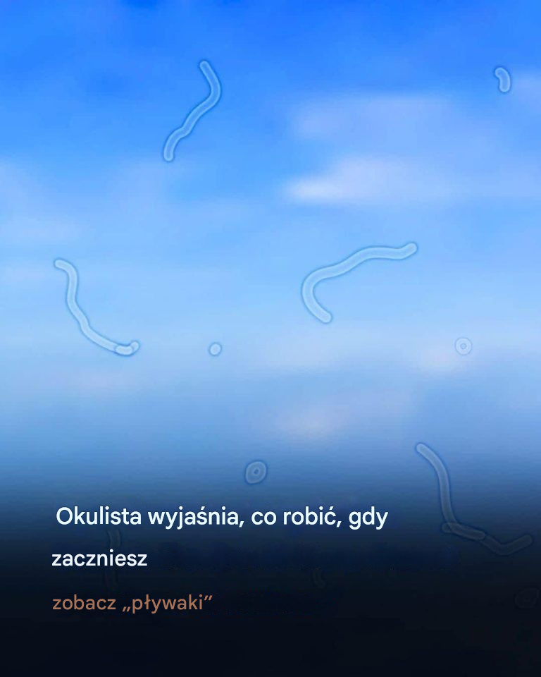 Czym są męty? Oto, co należy zrobić, jeśli zaczniesz je widzieć, według okulisty