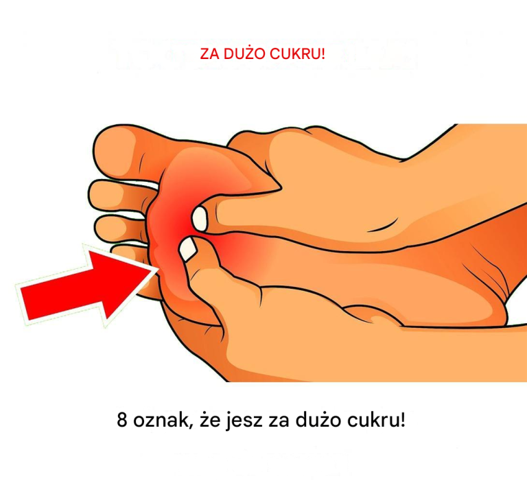 8 oznak, że jesz za dużo cukru!