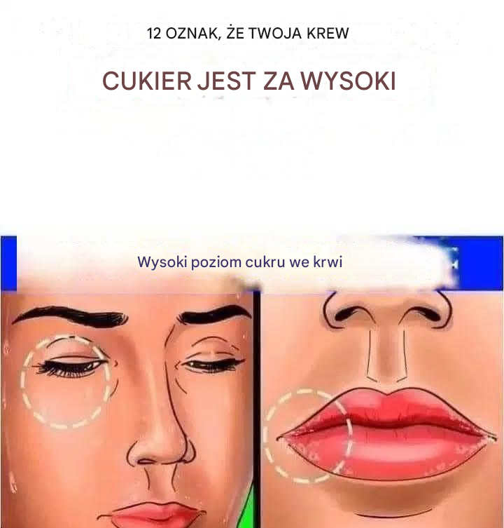 12 oznak, że poziom cukru we krwi jest zbyt wysoki