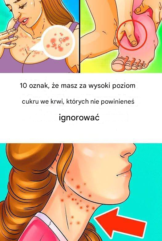 10 oznak, że jesz za dużo cukru