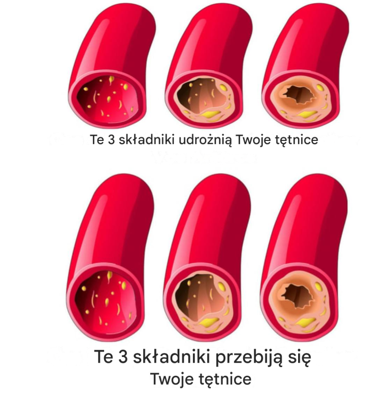 Oczyszczanie tętnic wieńcowych za pomocą zaledwie 3 składników