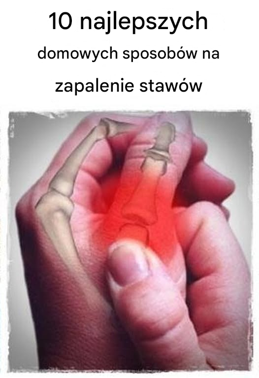 10 najlepszych domowych sposobów na zapalenie stawów