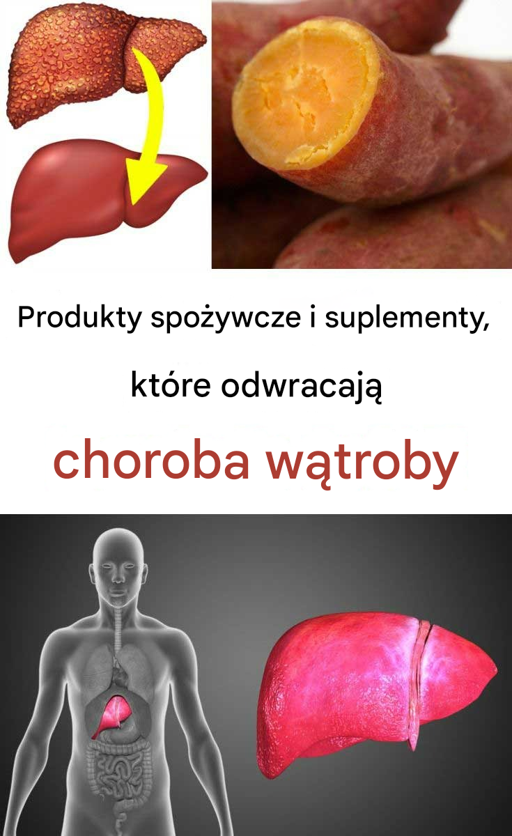 10 produktów spożywczych i suplementów, które odwracają chorobę wątroby