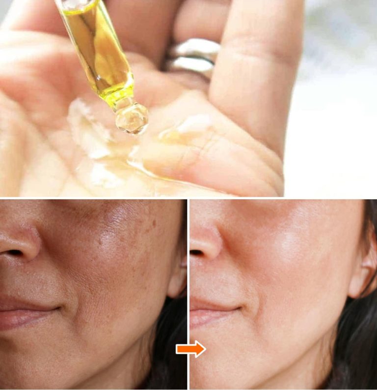 6 najlepszych olejków do twarzy, które usuwają niedoskonałości i rozświetlają skórę