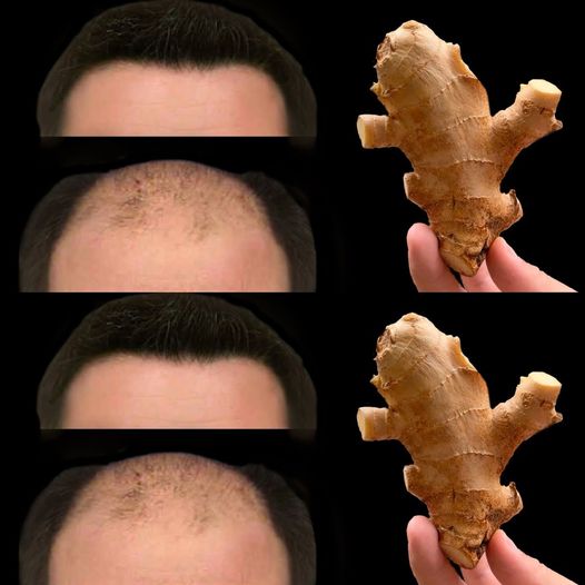 🔥 Wystarczą 3 silne składniki, a Twoje włosy będą rosły super szybko!