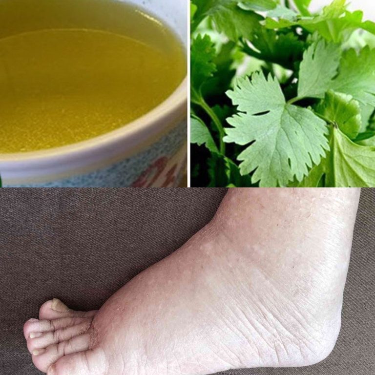 Usunie to nadmiar wody z organizmu i pomoże Ci schudnąć