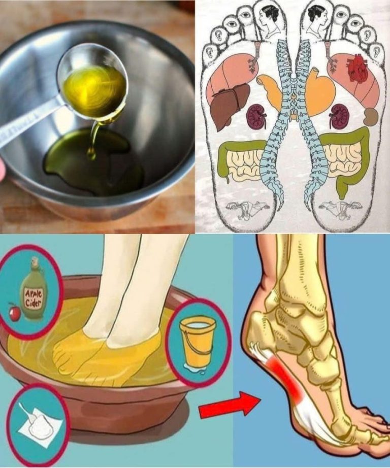Naturalne łagodzenie bólu: prosty 3-składnikowy środek na szybką ulgę