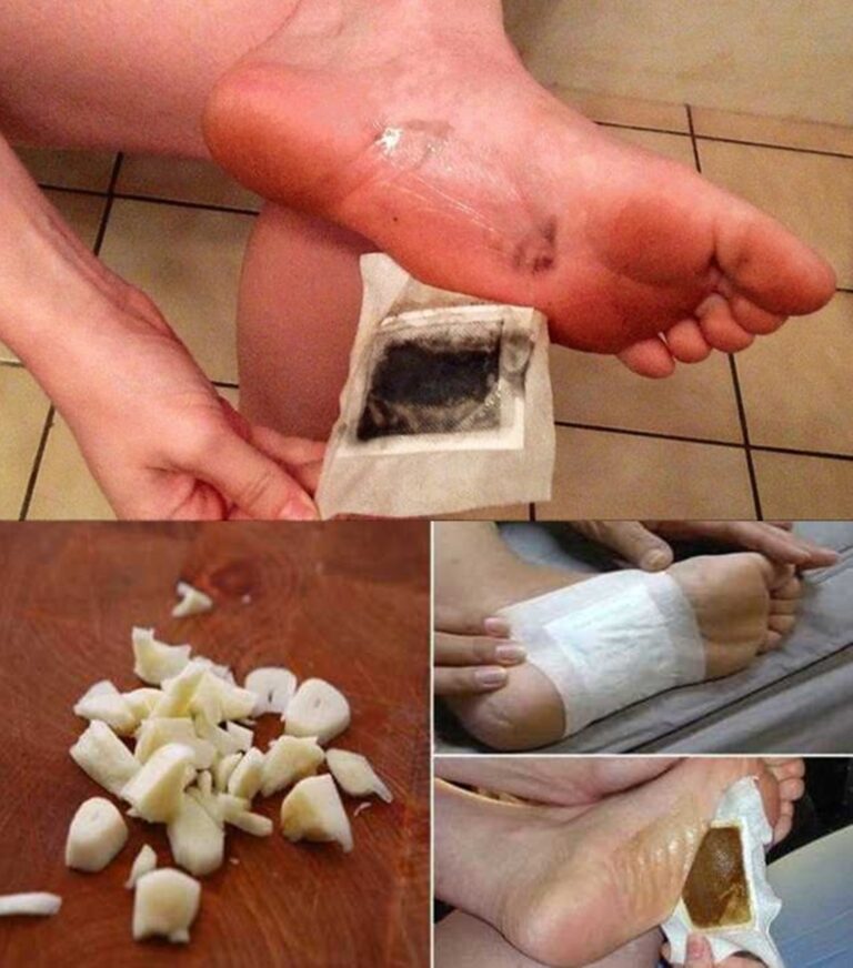 Kompres detoksykacyjny w celu usunięcia toksyn