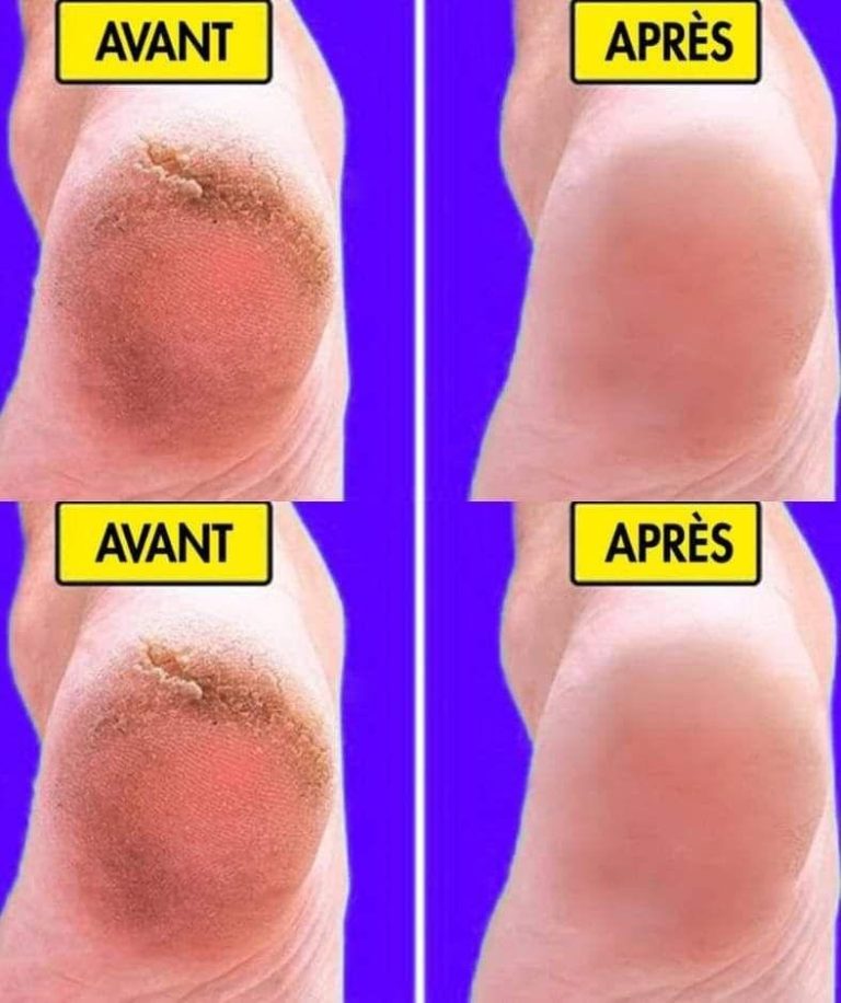 Domowy przepis na miękkie i gładkie stopy w 10 minut