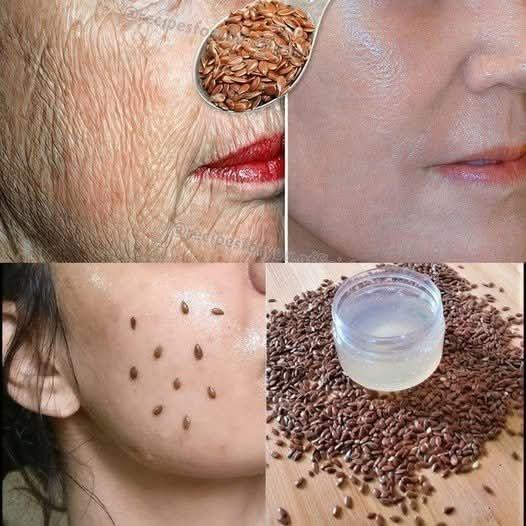 Nawet jeśli masz 70 lat, stosuj go na zmarszczki – Twoja twarz stanie się jędrniejsza jak szkło! Silniejszy niż botoks!