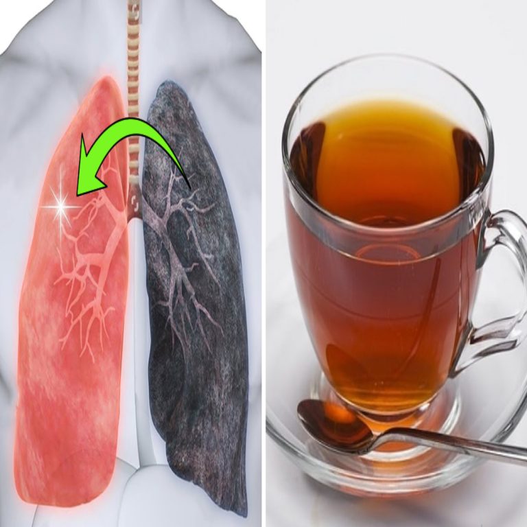 Jak oczyścić płuca i pozbyć się nikotyny, śluzu i pozostałości toksyn