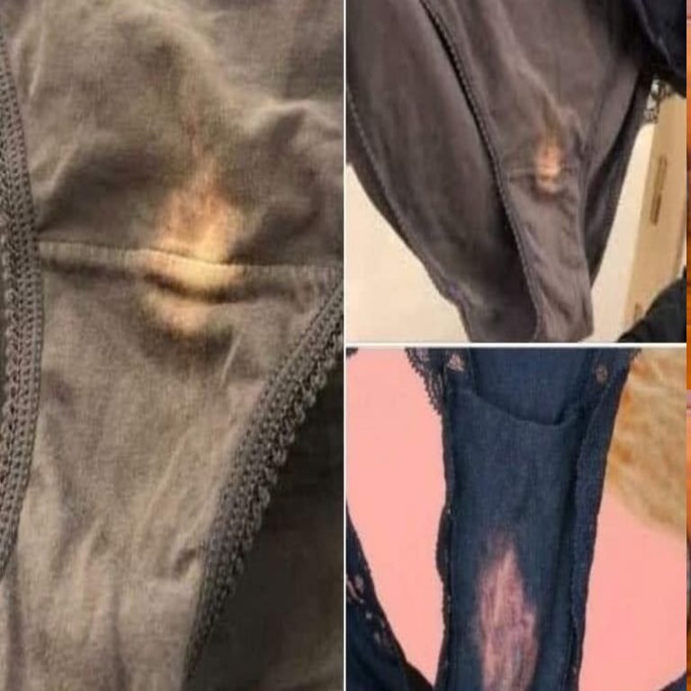 Jeśli znajdziesz plamę z wybielacza na bieliźnie, lepiej wiedz, co to oznacza 😮 Nie miałam pojęcia...