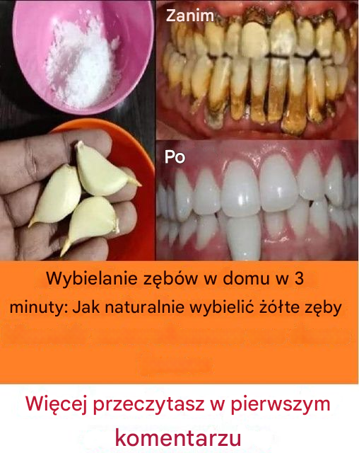 5 wskazówek, jak naturalnie pozbyć się płytki nazębnej!