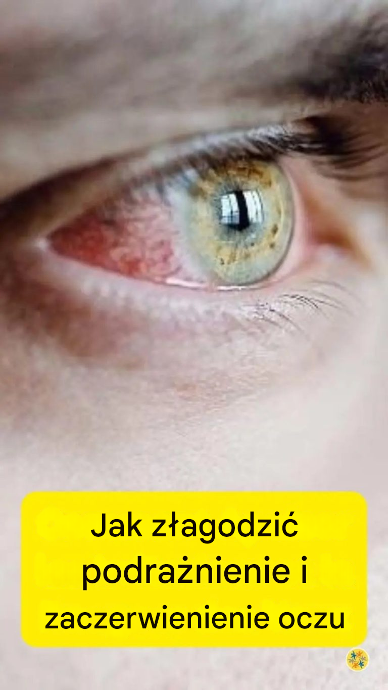 Jedzenie, które w mgnieniu oka uleczy Twoje podrażnione oczy!!