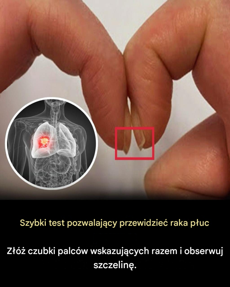 Zatwierdzony przez lekarzy test palca może wykryć poważne problemy zdrowotne