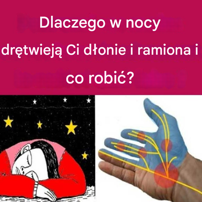 Dlaczego Twoje dłonie lub ramiona zasypiają w nocy i co z tym zrobić